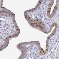 Anti-KIF21A antibody produced in rabbit 