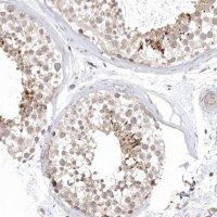 Anti-KIF2B antibody produced in rabbit 