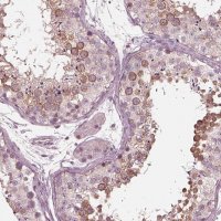 Anti-KIF6 antibody produced in rabbit 