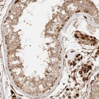 Anti-KIF9 antibody produced in rabbit HPA022031-100UL