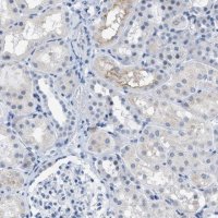Anti-KIFC3 antibody produced in rabbit 