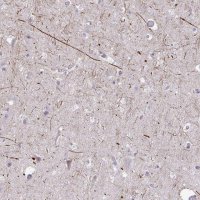 Anti-KIRREL3 antibody produced in rabbit 