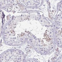 Anti-KISS1 antibody produced in rabbit 