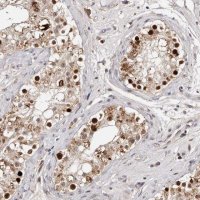 Anti-KLF7 antibody produced in rabbit 