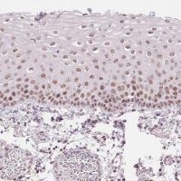 Anti-KLHDC9 antibody produced in rabbit 