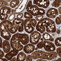 Anti-KLHL25 antibody produced in rabbit 