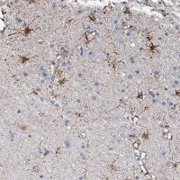 Anti-KLHL32 antibody produced in rabbit 