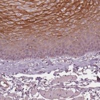 Anti-KLK13 antibody produced in rabbit 