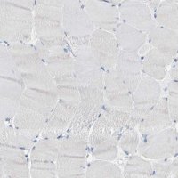Anti-KLK5 antibody produced in rabbit 
