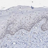 Anti-KMT2D antibody produced in rabbit 