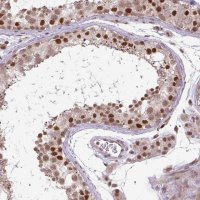 Anti-KPNA1 antibody produced in rabbit 