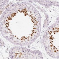 Anti-KPNA5 antibody produced in rabbit 