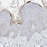 Anti-KPRP antibody produced in rabbit 
