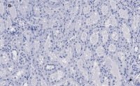 Anti-KRas Antibody, clone 2J13, ZooMAb Rabbit Monoclonal 