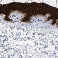Anti-KRT1 antibody produced in rabbit 