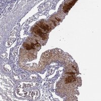 Anti-KRT12 antibody produced in rabbit 