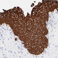 Anti-KRT19 antibody produced in rabbit 