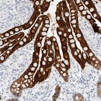 Anti-KRT20 antibody produced in rabbit 