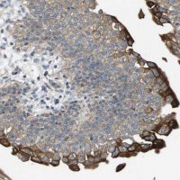 Anti-KRT23 antibody produced in rabbit 