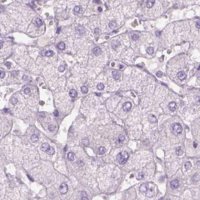 Anti-KRT25 antibody produced in rabbit 