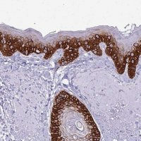 Anti-KRT5 antibody produced in rabbit 