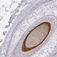 Anti-KRT82 antibody produced in rabbit 