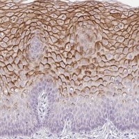 Anti-KRTDAP antibody produced in rabbit 