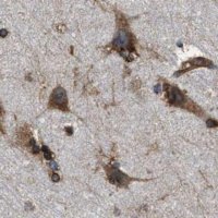 Anti-KTN1 antibody produced in rabbit 