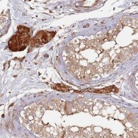 Anti-LACC1 antibody produced in rabbit 