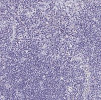 Anti-LAMC3 antibody produced in rabbit 