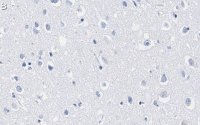 Anti-Lamin A/C Antibody, clone 2B10 ZooMAb Rabbit Monoclonal 