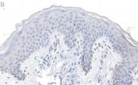 Anti-Laminin-5 2 Antibody, clone D4B5 ZooMAb Mouse Monoclonal 