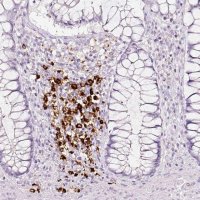 Anti-LAMP3 antibody produced in rabbit 