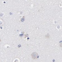 Anti-LAX1 antibody produced in rabbit HPA002461-100UL