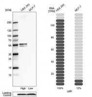 Anti-LBR antibody produced in rabbit 