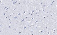 Anti-LC3A Antibody, clone 3J12 ZooMAb Rabbit Monoclonal 