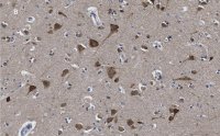 Anti-LC3B Antibody, clone 12K5, ZooMAb Rabbit Monoclonal 