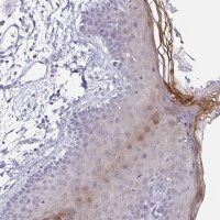 Anti-LCE6A antibody produced in rabbit 