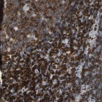 Anti-LCK antibody produced in rabbit 