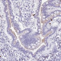 Anti-LCN15 antibody produced in rabbit 
