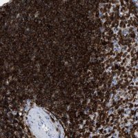 Anti-LCP1 antibody produced in rabbit 