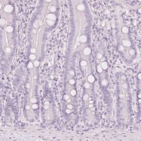 Anti-LECT2 antibody produced in rabbit 