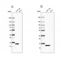 Anti-LGALS1 antibody produced in rabbit 