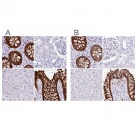 Anti-LGALS4 antibody produced in rabbit 