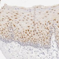 Anti-LGALS7 antibody produced in rabbit HPA001549-100UL