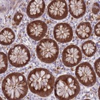 Anti-LGALS9 antibody produced in rabbit 