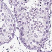 Anti-LGSN antibody produced in rabbit 