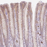 Anti-LHFPL5 antibody produced in rabbit 
