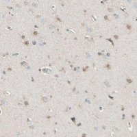 Anti-LHPP antibody produced in rabbit 