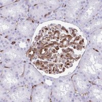 Anti-LIMS2 antibody produced in rabbit 